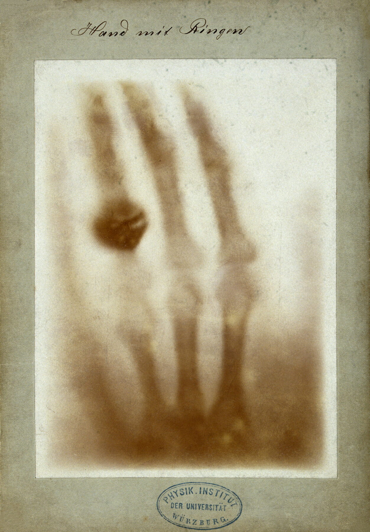 Wilhelm Röntgen, "Bones of a hand with a ring on one finger, viewed through x-ray," photoprint from radiograph, 1895. Courtesy of Wellcome Collection