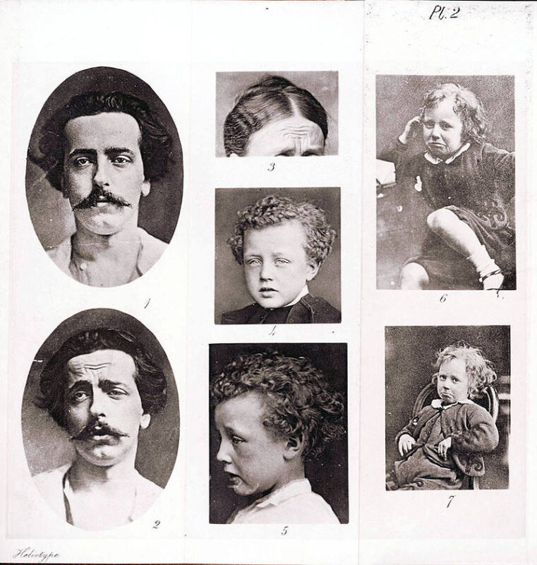 Several portraits of fair skinned people from the late 19th century are showcased. Two oval portraits of a man in his 20s with a moustache, a womans hairline, and several portraits of a 3-5 year old child frowning in most. The child is wearing a dark dress and has curly hair.
